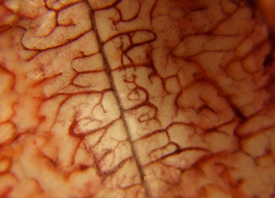 Brain Blood Vessels Texture 